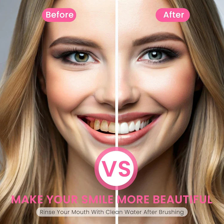 ✨Final 3 Hours: 50% OFF 💥 Nicotinamide Whitening Toothpaste 【New Upgrade】