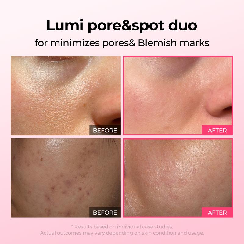 ✨Final 3 Hours: 50% OFF 💥Spot Care Duo | Shrinks Pores & Fades Blemish Marks in 2 Weeks | Cyano Pink Spicule Serum+ Picotonic Shot Ampoule(Two bottles form a set)