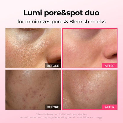 ✨Final 3 Hours: 50% OFF 💥Spot Care Duo | Shrinks Pores & Fades Blemish Marks in 2 Weeks | Cyano Pink Spicule Serum+ Picotonic Shot Ampoule(Two bottles form a set)