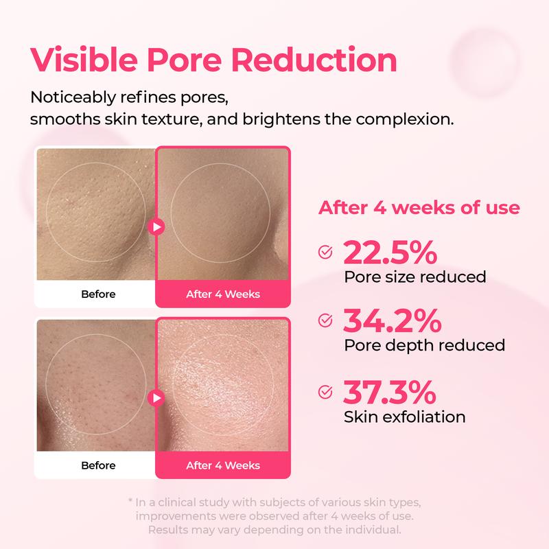 ✨Final 3 Hours: 50% OFF 💥Spot Care Duo | Shrinks Pores & Fades Blemish Marks in 2 Weeks | Cyano Pink Spicule Serum+ Picotonic Shot Ampoule(Two bottles form a set)
